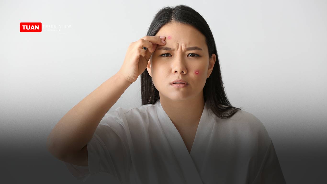 Vì sao mụn ẩn hình thành
